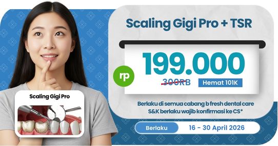 Scaling Gigi Pro + TSR